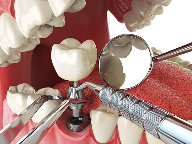 Best Emergency Cosmetic Dentistry (e.g., broken veneers) in Plainwell, MI